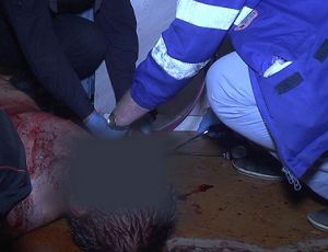 Кровь по всей квартире: в Екатеринбурге неадекватный мужчина пытался отрезать себе нос (ФОТО)