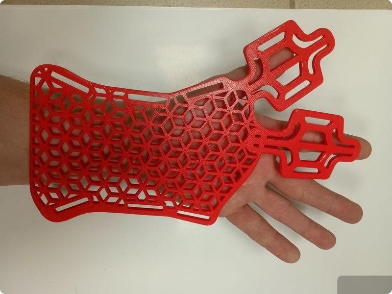 Новый День: В уральском госпитале заменили гипс конструкциями, напечатанными на 3D-принтере (ФОТО)